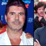 Simon Cowell Todesursache
