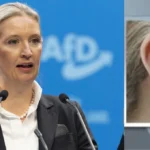 Alice Weidel Ohrprothese