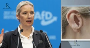 Alice Weidel Ohrprothese: Die AFD-Spitzenkandidatin für die Bundestagswahl 2025