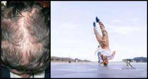 Verliert man durch Headspins Haare? Die Auswirkungen auf das Haar von Breakdancern