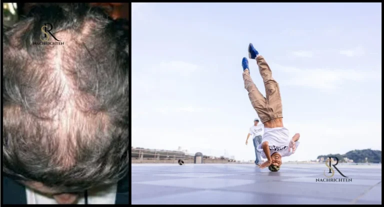 Verliert man durch Headspins Haare